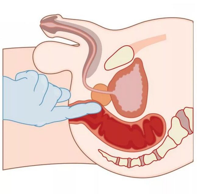 Τοποθεσία ανδρικού σημείου G